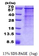 Human VISA / MAVS Protein (Recombinant His)