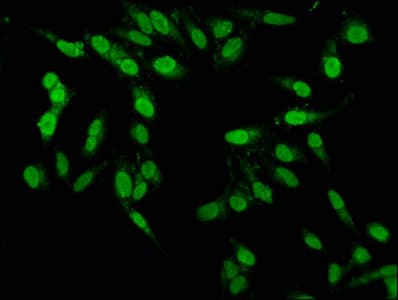 PBX1 Antibody