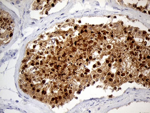 RACGAP1 / MGCRACGAP Antibody (aa123-238, clone OTI3A5, Carrier-free)