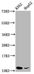 Polyclonal Rabbit anti-Human SNRPE Antibody (IHC, IF, WB)