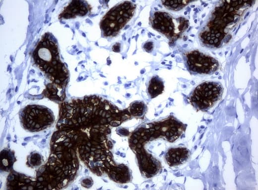 KRT19 / CK19 / Cytokeratin 19 Antibody (aa240-390, clone UMAB2)