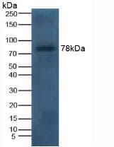 LF / LTF / Lactoferrin Antibody (aa28-351)
