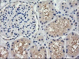 Monoclonal Mouse anti-Human TRIM38 Antibody (clone OTI1D6, IHC, WB)