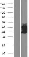 CT47A3 Protein (Over-Expression Lysate Myc-DDK (Flag))