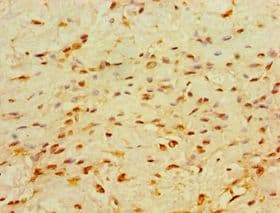 CHD1 Antibody (aa1501-1710)
