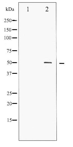 AML1 / RUNX1 Antibody (phospho-Ser276)