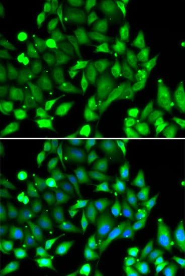 STAT4 Antibody