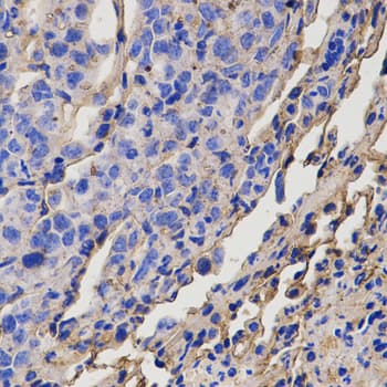 DRD5 / Dopamine Receptor D5 Antibody