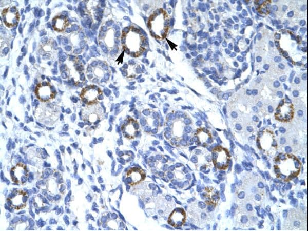 Polyclonal Rabbit anti-Human TMEM259 / Membralin Antibody (aa262-311, IHC, WB)