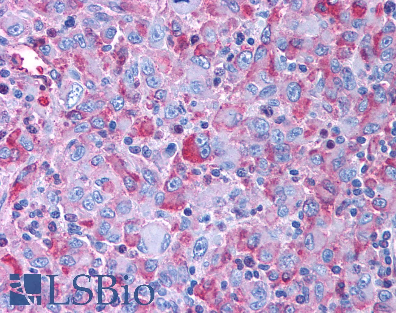 PathPlus™ Polyclonal Rabbit anti-Human CRFR1 / CRHR1 Antibody (Extracellular Domain, IHC)
