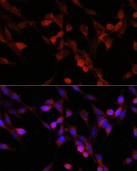 TERE1 / UBIAD1 Antibody
