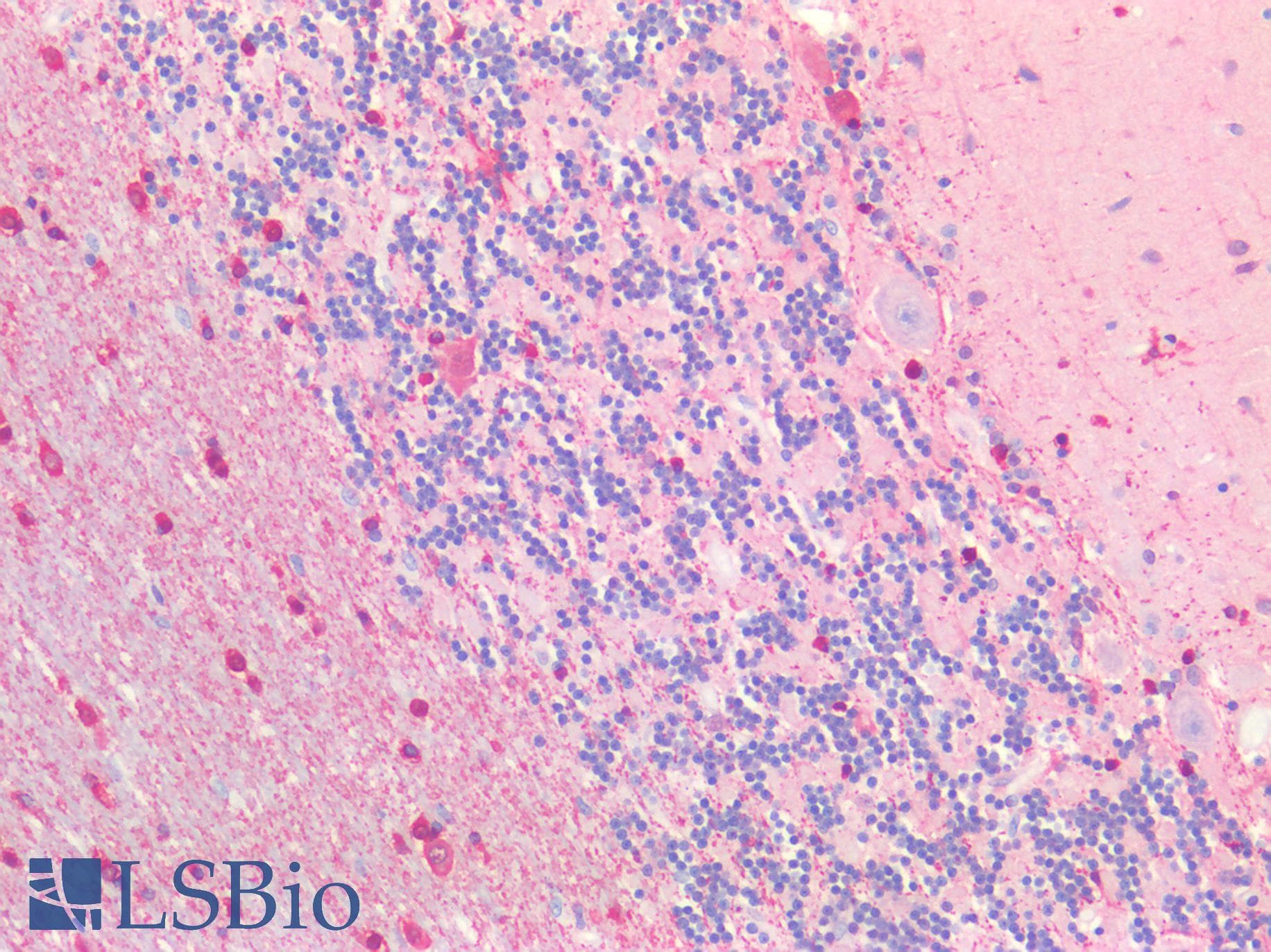 IHC-plus™ Polyclonal Rabbit anti-Human SLC6A3 / Dopamine Transporter Antibody (IHC)