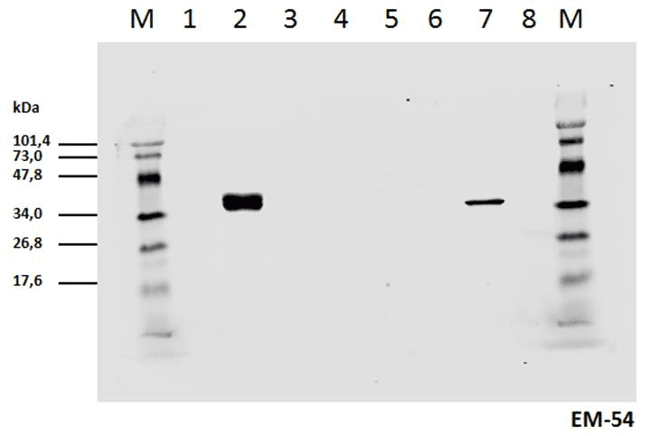 Monoclonal Mouse anti-Human CD247 / CD3 Zeta Antibody (clone EM-54, phospho-Tyr142, WB)