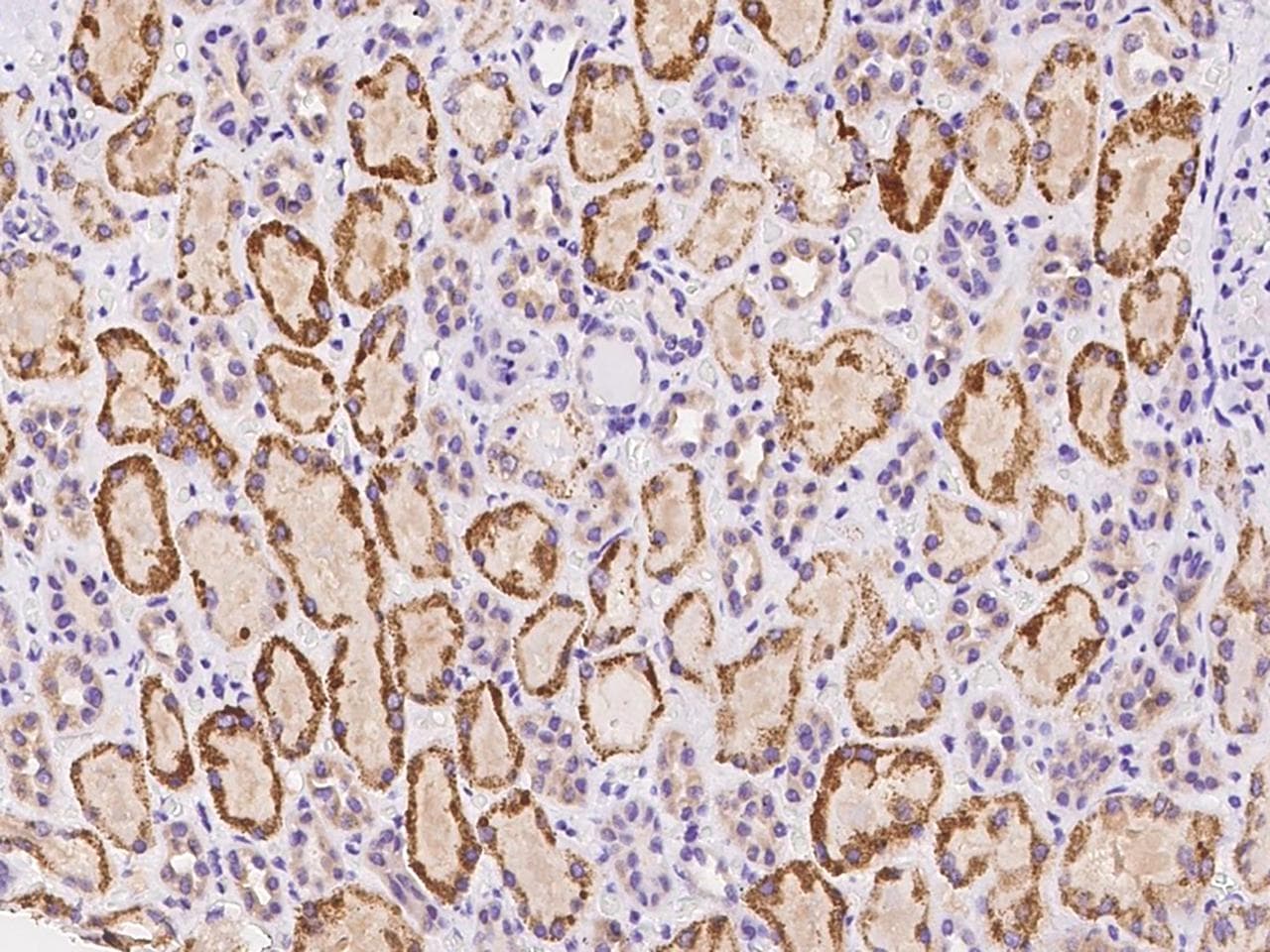 Polyclonal Rabbit anti-Human ADGRF3 / GPR113 Antibody (IHC)