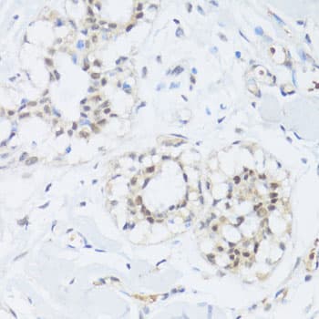 Polyclonal Rabbit anti-Human EP300 / p300 Antibody (IHC, WB)
