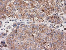 CDCP1 Antibody (clone 2B8, Carrier-free)
