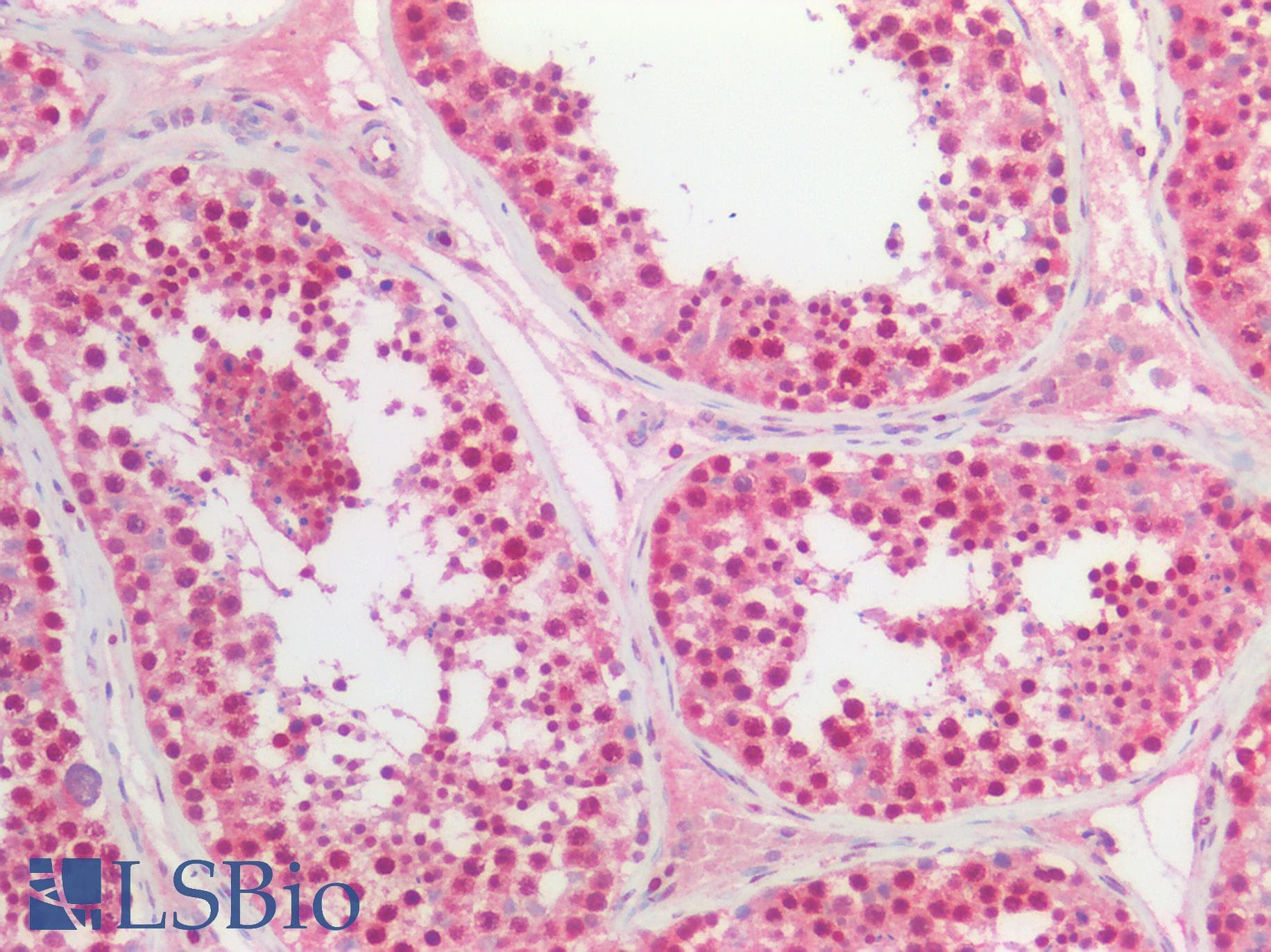 IHC-plus™ BCL2L1 / BCL-XL Antibody (aa1-208)