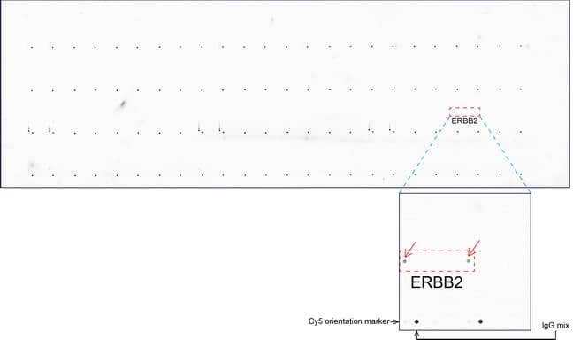ERBB2 / HER2 Antibody (aa676-1255, clone UMAB33)