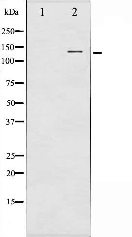 NOS1 / nNOS Antibody (phospho-Ser852)