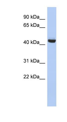 EXOC4 / SEC8 Antibody (N-Terminus)