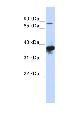 Polyclonal Rabbit anti-Human LONRF2 Antibody (aa576-625, WB)