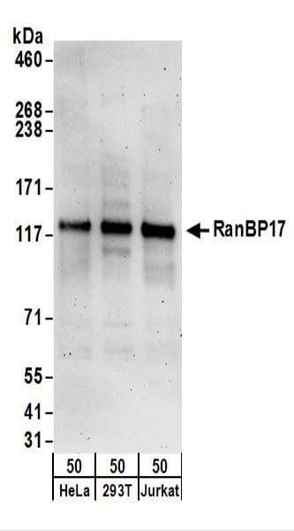 RANBP17 Antibody (aa1000-1050)