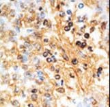 DOK1 Antibody (aa9-39)