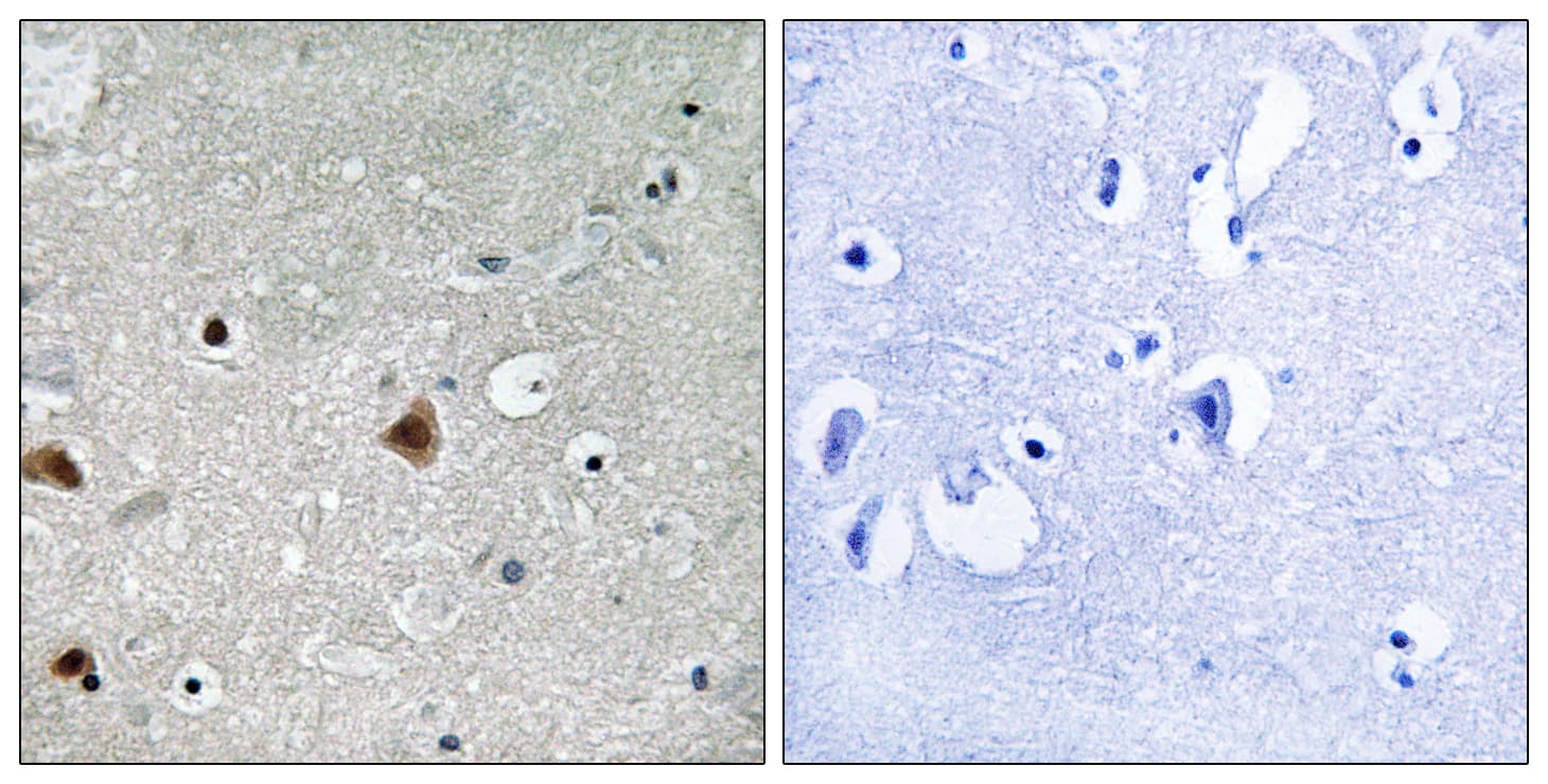Polyclonal Rabbit anti-Human GPS1 / CSN1 Antibody (phospho-Ser454, IHC)