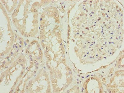 Polyclonal Rabbit anti-Human OVOL1 Antibody (IHC, WB)