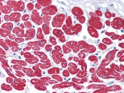 MYL3 Antibody (clone 7C1)