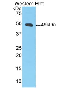 LP-PLA2 / PLA2G7 Antibody (aa22-440, Biotin)