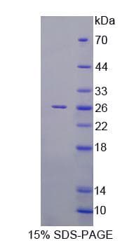 Human RAB1A Protein (Recombinant)