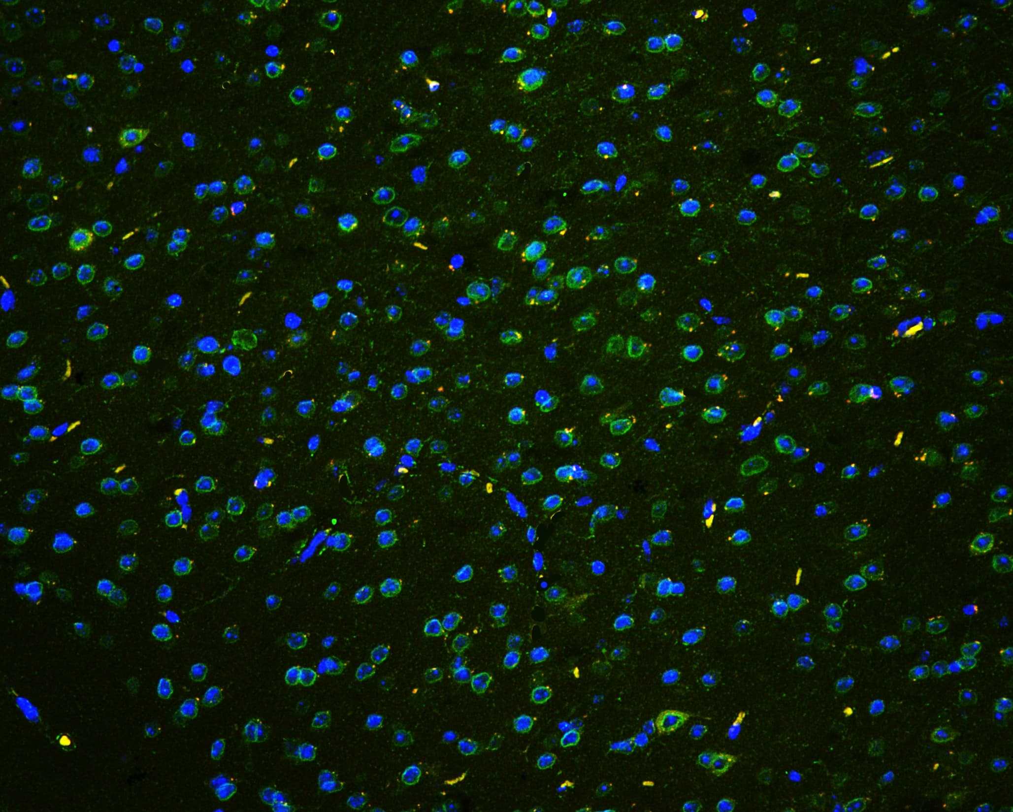 TPR Antibody