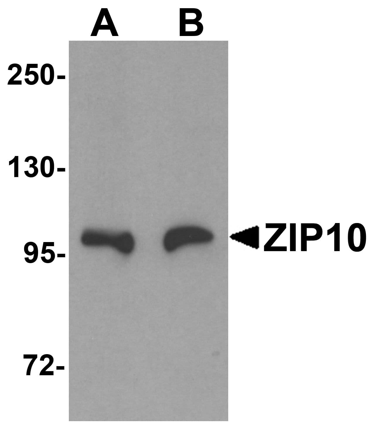 IHC-plus™ SLC39A10 / ZIP10 Antibody