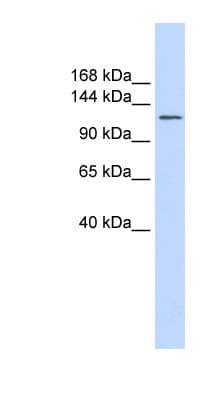 Polyclonal Rabbit anti-Human SLC24A1 / NCKX Antibody (aa612-661, IHC, WB)
