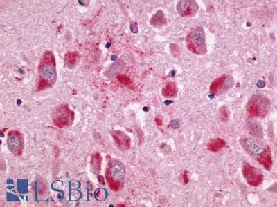 PathPlus™ Polyclonal Rabbit anti-Human NMUR2 Antibody (C-Terminus, IHC)