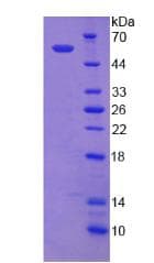 Human THRA / THR Alpha Protein (Recombinant His)