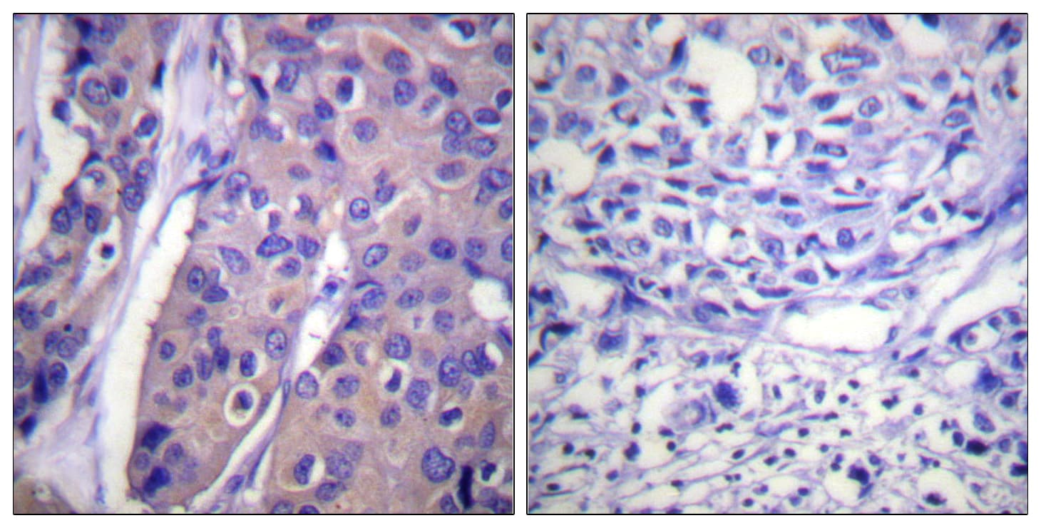 RAF1 / RAF Antibody (phospho-Ser296)