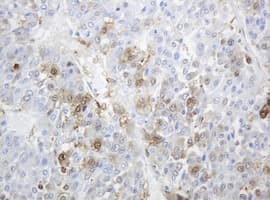 TP / Thymidine Phosphorylase Antibody (aa311-482, clone OTI1E7, Carrier-free)