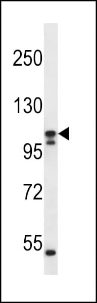 SLC12A6 / KCC3 Antibody (aa13-42)