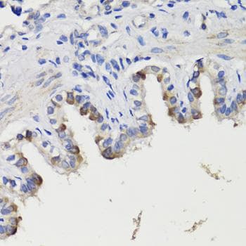 DEPTOR / DEPDC6 Antibody