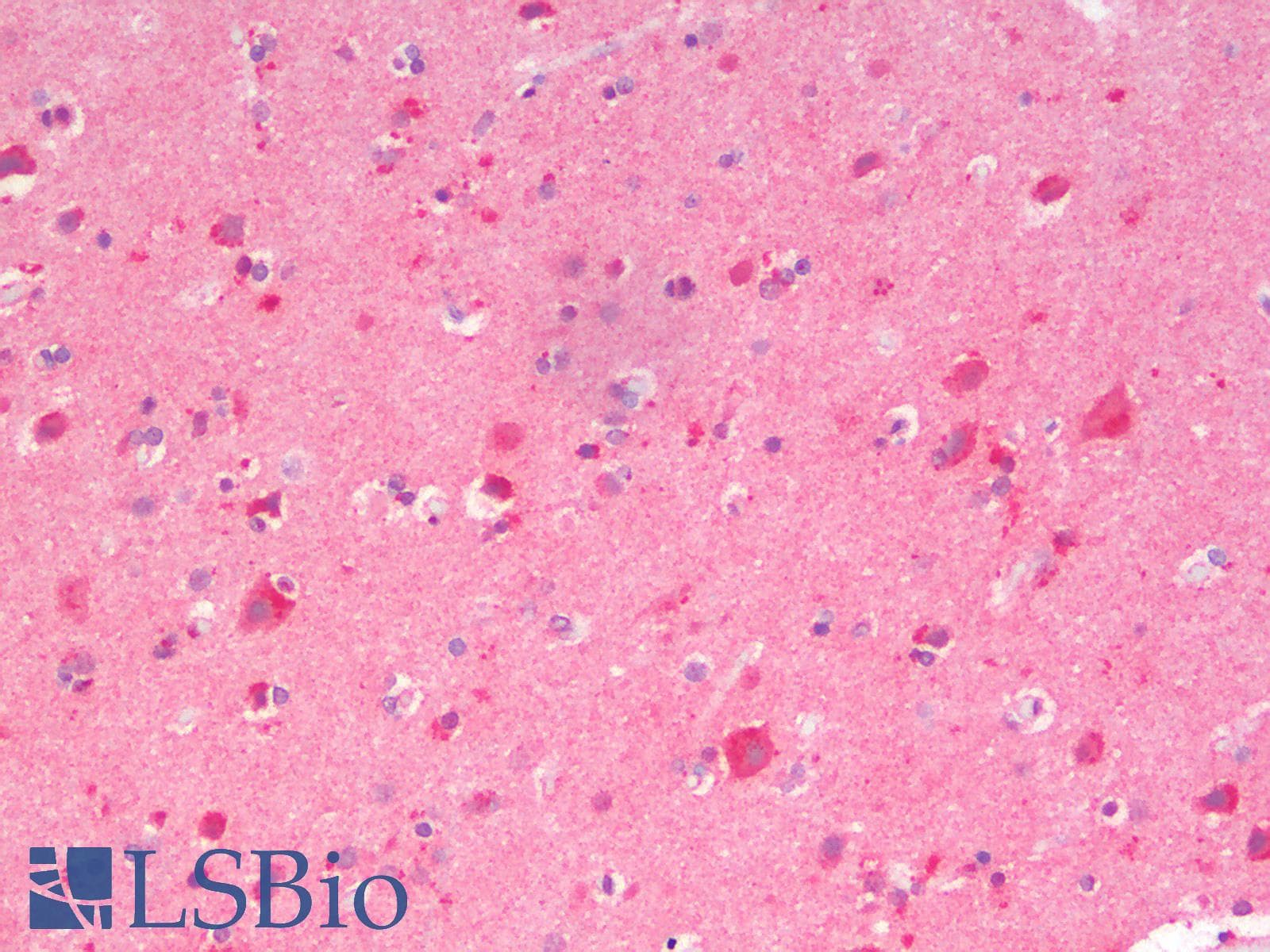 PathPlus™ Polyclonal Rabbit anti-Mouse CTNNB1 / Beta Catenin Antibody (IHC, IF, WB)