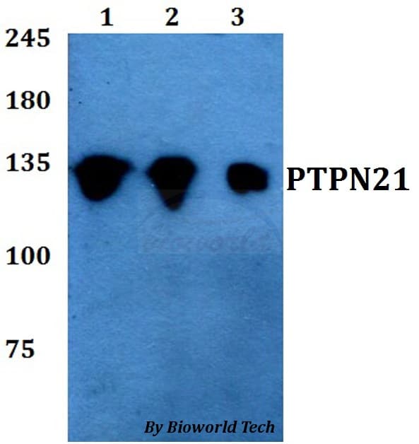 Polyclonal Rabbit anti-Human PTPN21 / PTPD1 Antibody (WB)