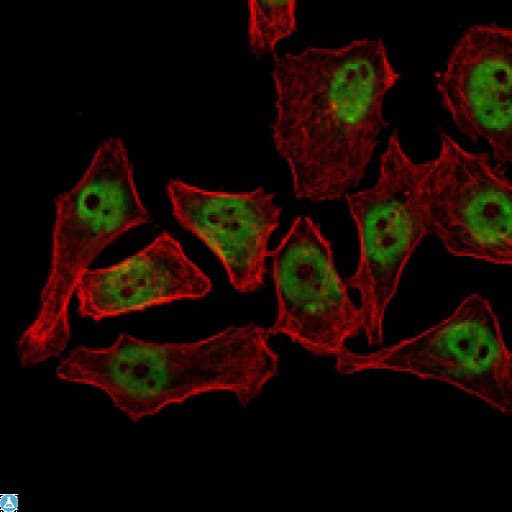 Monoclonal Mouse anti-Human CTG-B45d / THAP11 Antibody (IHC, IF, WB)