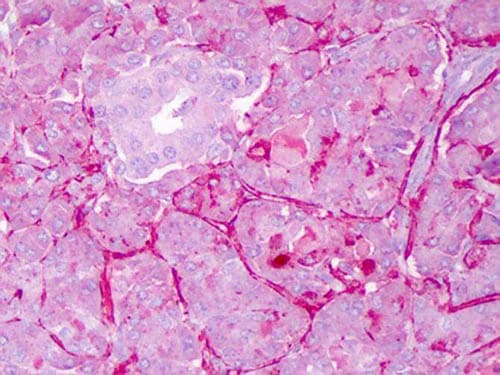 NOTCH1 Antibody (N-Terminus)