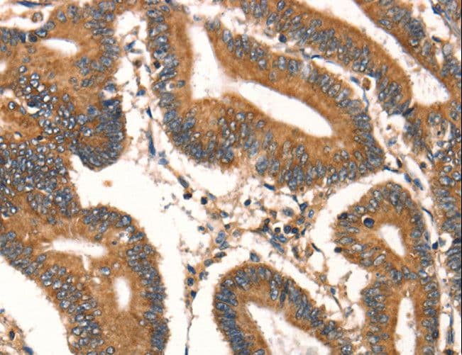 DAP Antibody