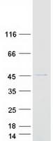 Human MRPS22 Protein (Recombinant Myc-DDK (Flag))
