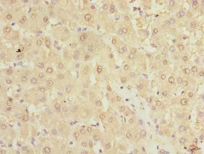 TMPRSS6 Antibody