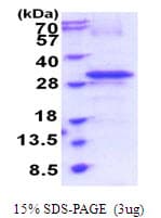 Human RTP4 / IFRG28 Protein (Recombinant His)