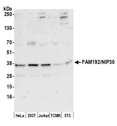 Polyclonal Rabbit anti-Human FAM192A / Nip30 Antibody (aa125-175, WB)
